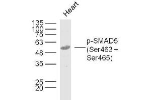 Mouse heart lysates probed with SMAD5 (Ser463 + Ser465) Polyclonal Antibody, Unconjugated  at 1:300 dilution and 4˚C overnight incubation. (SMAD5 antibody  (pSer463, pSer465))