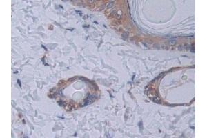 Immunohistochemistry (IHC) image for anti-Signal Transducer and Activator of Transcription 2, 113kDa (STAT2) (AA 587-838) antibody (ABIN7443368)