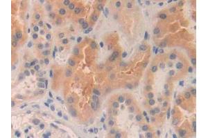 DAB staining on IHC-P; Samples: Human Kidney Tissue (MMP24 antibody  (AA 429-642))