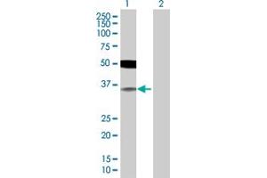 Lane 1: IRF2 transfected lysate ( 38.