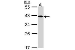 WB Image Sample (30 ug of whole cell lysate) A: A431 , 10% SDS PAGE antibody diluted at 1:1000 (eIF2B beta (Center) antibody)