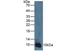 Rabbit Detection antibody from the kit in WB with Positive Control: Human A431 cells. (S100A2 ELISA Kit)