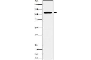Western blot analysis of SEC24D expression in HeLa cell lysate. (Recombinant SEC24D antibody)