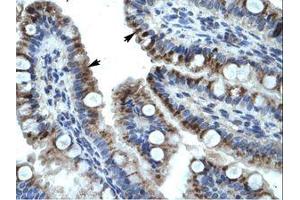 Image no. 1 for anti-Keratin 15 (KRT15) (C-Term) antibody (ABIN6735909) (KRT15 antibody  (C-Term))