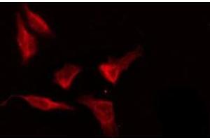 ABIN6276189 staining HeLa by IF/ICC. (OR8G5 antibody  (Internal Region))