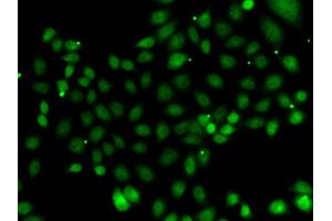 Immunofluorescence analysis of MCF-7 cells using NFYB antibody (ABIN5974397). (NFYB antibody)