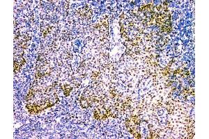 IHC analysis of NFIA using anti-NFIA antibody (ABIN6719349). (NFIA antibody  (Middle Region))