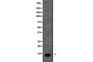 Western blot analysis of KCNE2 expression in Pancreas (Mouse) Tissue Lysate ,The lane on the left is treated with the antigen-specific peptide.