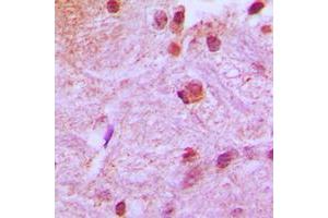 Immunohistochemical analysis of RUNX2 staining in human brain formalin fixed paraffin embedded tissue section. (RUNX2 antibody  (Center))