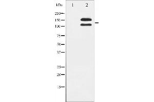 Western blot analysis of c-Kit phosphorylation expression in HeLa whole cell lysates,The lane on the left is treated with the antigen-specific peptide.