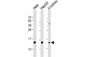 All lanes : Anti-PFN1 Antibody (C-term) at 1:2000 dilution Lane 1: Hela whole cell lysates Lane 2: HepG2 whole cell lysates Lane 3: human kidney lysates Lysates/proteins at 20 μg per lane.