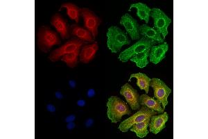 ABIN7094516 and ABIN7098565 staining Hela cells by IF/ICC. (CD20 antibody  (C-Term))
