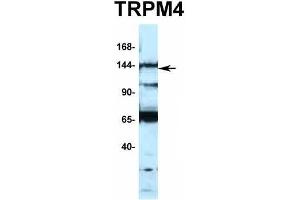 Host:  Rabbit  Target Name:  TRPM4  Sample Type:  Jurkat  Antibody Dilution:  1. (TRPM4 antibody  (N-Term))