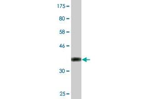 Western Blot detection against Immunogen (36. (GSTM2 antibody  (AA 90-189))