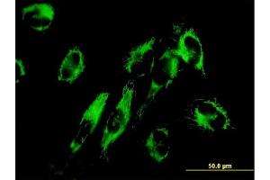 Immunofluorescence of monoclonal antibody to NNT on HepG2 cell. (NNT antibody  (AA 1-207))
