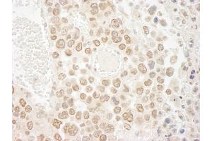 Immunohistochemistry (IHC) image for anti-Denticleless E3 Ubiquitin Protein Ligase Homolog (DTL) (C-Term) antibody (ABIN7448536)