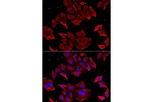 Immunofluorescence analysis of HeLa cells using TCAP antibody. (TCAP antibody)