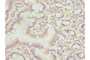 Immunohistochemistry of paraffin-embedded human small intestine tissue using ABIN7158480 at dilution of 1:100 (Uncharacterized Protein C7orf34 (LLCFC1) (AA 29-122) antibody)