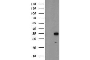 Western Blotting (WB) image for anti-Myeloid Leukemia Factor 1 (MLF1) antibody (ABIN1499494) (MLF1 antibody)