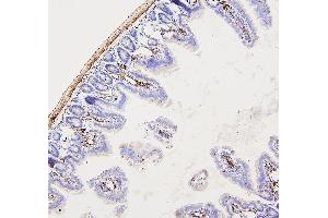 IHC analysis of FLNA using anti-FLNA antibody (ABIN7601782).