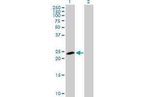 Western Blot analysis of NOP16 expression in transfected 293T cell line by NOP16 MaxPab polyclonal antibody. (NOP16 antibody  (AA 1-178))