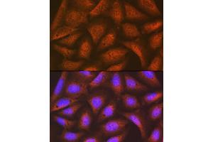 Immunofluorescence (IF) image for anti-Eukaryotic Translation Initiation Factor 2B, Subunit 5 Epsilon, 82kDa (EIF2B5) antibody (ABIN7267038)