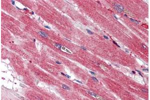 Human Heart (formalin-fixed, paraffin-embedded) stained with S100A4 antibody ABIN337243 at 2. (s100a4 antibody)