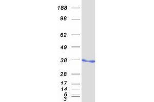 Validation with Western Blot (SMN1 / SMN2 (Transcript Variant B) protein (Myc-DYKDDDDK Tag))