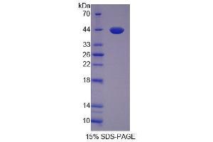 SDS-PAGE analysis of Human VGF Protein. (VGF Protein)