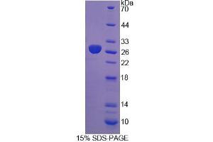 SDS-PAGE analysis of Rat DTNBP1 Protein.