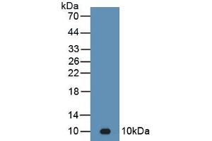 Detection of Recombinant C4b, Mouse using Polyclonal Antibody to Complement C4-B (C4B) (C4B antibody  (AA 126-366))