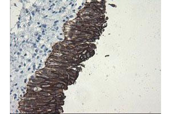 SLAP2 antibody