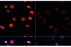 Immunofluorescence (IF) image for anti-Histone H2B (acLys5) antibody (ABIN7258524)