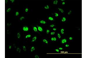 Immunofluorescence of monoclonal antibody to MPG on HeLa cell. (MPG antibody  (AA 1-90))