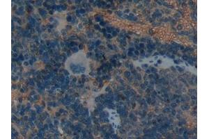 Immunohistochemistry (IHC) image for anti-Leukemia Inhibitory Factor Receptor alpha (LIFR) (AA 382-486) antibody (ABIN7437992)