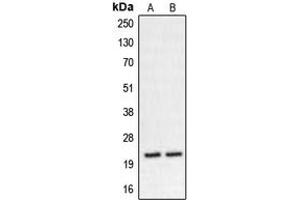 Western blot analysis of CHP2 expression in K562 (A), HT29 (B) whole cell lysates. (Chp2 antibody  (Center))