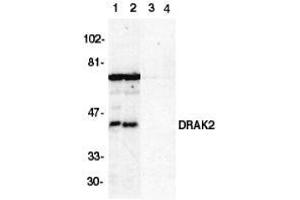 Western blot analysis of DRAK2 in Jurkat (1,3) and Raji (2,4) cell lysate in the absence (1,2) or presence (3,4) of blocking peptide with AP30303PU-N DRAK2 antibody at 1/500 dilution. (DRAK2 antibody  (C-Term))