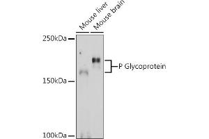 Western blot analysis of extracts of various cell lines, using P Glycoprotein Rabbit pAb (ABIN6134228, ABIN6136339, ABIN6136342 and ABIN6215442) at 1:1000 dilution. (ABCB1 antibody  (AA 600-700))