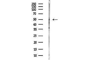 Western blot analysis of lysates from Hela cells(heat-shock,45 min treatment), using HMGCS2 Antibody at 1/1000 dilution.