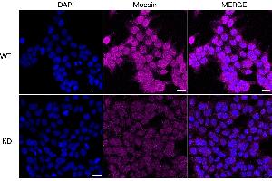 Immunocytochemical staining of HeLa cells using Moesin antibody (ABIN7799482), 1:1,000), Top panel: wild-type (WT), Bottom panal: Moesin shRNA knockdown (KD).