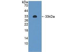 Detection of Recombinant ITGa2, Human using Monoclonal Antibody to Integrin Alpha 2 (ITGa2) (ITGA2 antibody  (AA 74-277))