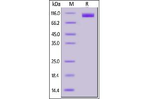Cynomolgus ACE2, His Tag on SDS-PAGE under reducing (R) condition. (ACE2 Protein (His tag))