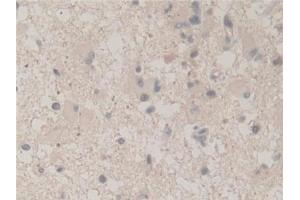 Immunohistochemistry (IHC) image for anti-Ubiquitin A-52 Residue Ribosomal Protein Fusion Product 1 (UBA52) (AA 1-128) antibody (ABIN7441190)