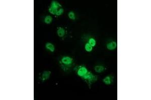 Anti-TP53 mouse monoclonal antibody (ABIN2454536) immunofluorescent staining of COS7 cells transiently transfected by pCMV6-ENTRY TP53 (RC200003). (p53 antibody)