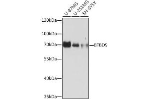 Western blot analysis of extracts of various cell lines, using BTBD9 Rabbit pAb (ABIN7265955) at 1:1000 dilution. (BTBD9 antibody)