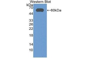 Western Blotting (WB) image for anti-Aldehyde Dehydrogenase 7 Family, Member A1 (ALDH7A1) (AA 1-539) antibody (ABIN3201764) (ALDH7A1 antibody  (AA 1-539))