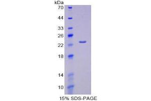 SDS-PAGE (SDS) image for Hexosaminidase B (Beta Polypeptide) (HEXB) (AA 122-311) protein (His tag) (ABIN2121239)