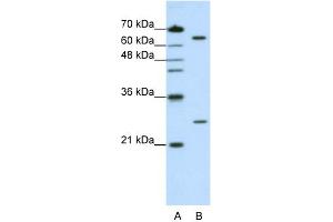 WB Suggested Anti-NUDT21 Antibody Titration:  1. (NUDT21 antibody  (N-Term))