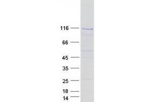 Validation with Western Blot (INTS5 Protein (Myc-DYKDDDDK Tag))