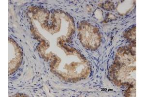 Image no. 2 for anti-Cytochrome P450, Family 7, Subfamily B, Polypeptide 1 (CYP7B1) (AA 203-287) antibody (ABIN599490) (CYP7B1 antibody  (AA 203-287))